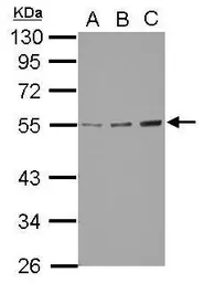Anti-GCNT3 antibody used in Western Blot (WB). GTX122901