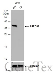 Anti-LRRC59 antibody used in Western Blot (WB). GTX122902