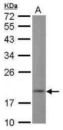 Anti-NT5C antibody [N1C3] used in Western Blot (WB). GTX122905