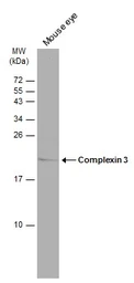Anti-Complexin 3 antibody used in Western Blot (WB). GTX122908
