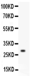 Anti-Kallikrein 1 antibody used in Western Blot (WB). GTX12293