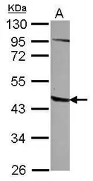Anti-AGPAT5 antibody [N1C2] used in Western Blot (WB). GTX122943