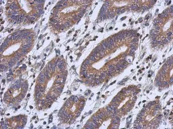 Anti-RFESD antibody used in IHC (Paraffin sections) (IHC-P). GTX122944