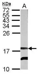 Anti-RFESD antibody used in Western Blot (WB). GTX122944