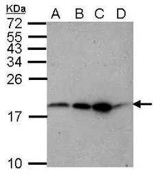 Anti-RFESD antibody used in Western Blot (WB). GTX122944