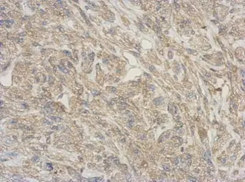 Anti-RNASE11 antibody used in IHC (Paraffin sections) (IHC-P). GTX122951