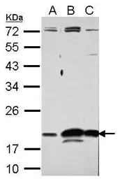 Anti-RNASE11 antibody used in Western Blot (WB). GTX122951