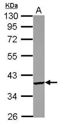 Anti-PDIK1L antibody [N2C3] used in Western Blot (WB). GTX122965