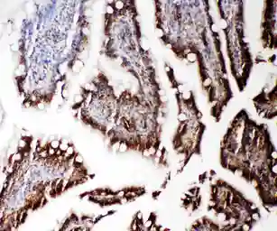 Anti-RGS3 antibody used in IHC (Paraffin sections) (IHC-P). GTX12297