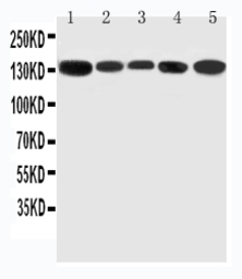Anti-RGS3 antibody used in Western Blot (WB). GTX12297