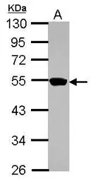 Anti-ZNF597 antibody used in Western Blot (WB). GTX122972