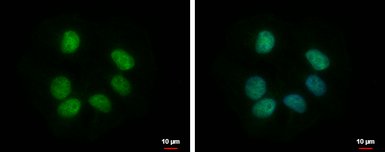 Anti-RBMY1F antibody used in Immunocytochemistry/ Immunofluorescence (ICC/IF). GTX122973