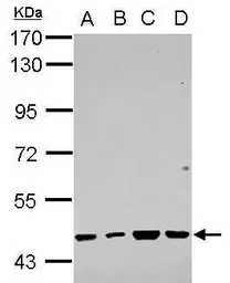 Anti-RBMY1F antibody used in Western Blot (WB). GTX122973