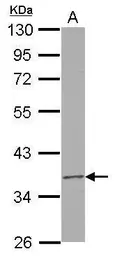 Anti-RPUSD3 antibody [N3C3] used in Western Blot (WB). GTX122992