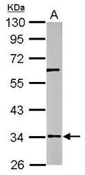 Anti-RPUSD3 antibody [N1C2] used in Western Blot (WB). GTX122993