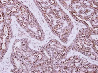 Anti-HIBADH antibody used in IHC (Paraffin sections) (IHC-P). GTX122994