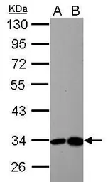 Anti-HIBADH antibody used in Western Blot (WB). GTX122994