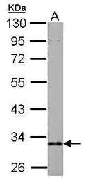 Anti-HIBADH antibody used in Western Blot (WB). GTX122994