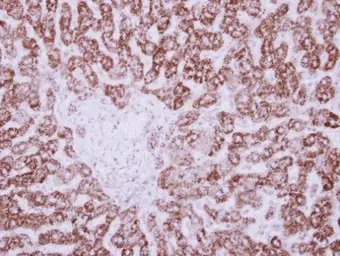 Anti-HIBADH antibody used in IHC (Paraffin sections) (IHC-P). GTX122995