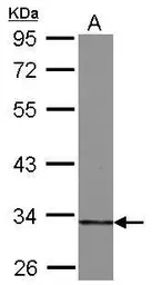 Anti-HIBADH antibody used in Western Blot (WB). GTX122995
