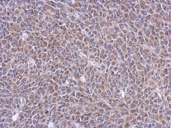 Anti-C5orf54 antibody used in IHC (Paraffin sections) (IHC-P). GTX123000