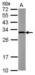 Anti-CBR4 antibody [N1C3] used in Western Blot (WB). GTX123009