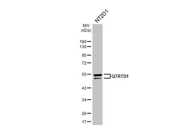 Anti-QTRTD1 antibody used in Western Blot (WB). GTX123016