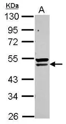 Anti-QTRTD1 antibody used in Western Blot (WB). GTX123016