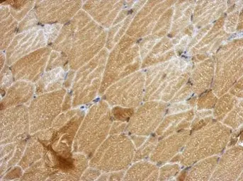 Anti-ANKRD53 antibody used in IHC (Paraffin sections) (IHC-P). GTX123019