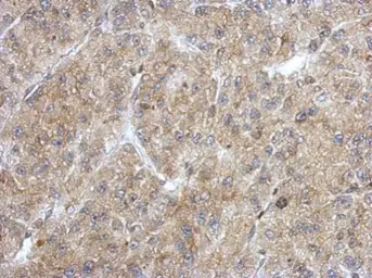 Anti-ANKRD53 antibody used in IHC (Paraffin sections) (IHC-P). GTX123019