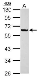 Anti-ANKRD53 antibody used in Western Blot (WB). GTX123019