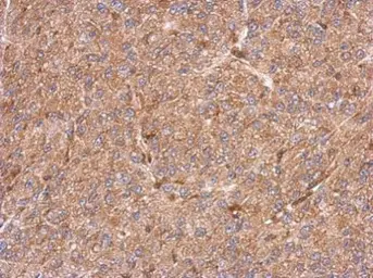 Anti-CCDC105 antibody [N2C2], Internal used in IHC (Paraffin sections) (IHC-P). GTX123024