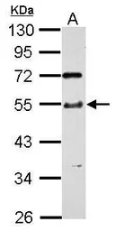 Anti-TTC31 antibody used in Western Blot (WB). GTX123032