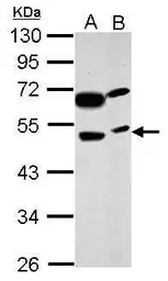 Anti-PRSS35 antibody used in Western Blot (WB). GTX123037