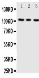Anti-ADAMTS1 antibody used in Western Blot (WB). GTX12304