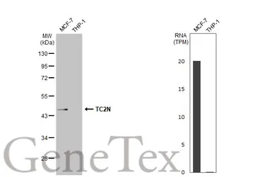 Anti-TC2N antibody used in Western Blot (WB). GTX123057
