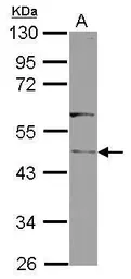 Anti-RLBP1L1 antibody used in Western Blot (WB). GTX123072
