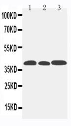 Anti-CCR5 antibody used in Western Blot (WB). GTX12309