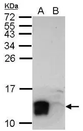 Anti-LYPD6 antibody used in Western Blot (WB). GTX123091