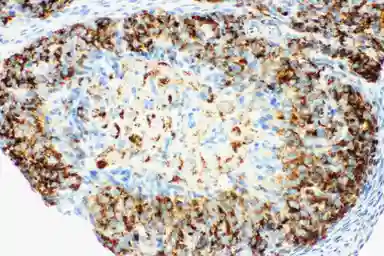 Anti-HSD17B1 antibody used in IHC (Paraffin sections) (IHC-P). GTX12312