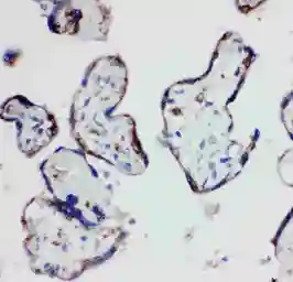 Anti-HSD17B1 antibody used in IHC (Paraffin sections) (IHC-P). GTX12312