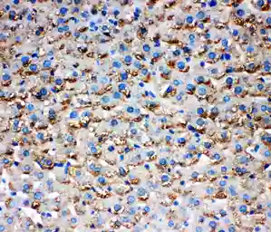 Anti-HSD17B1 antibody used in IHC (Paraffin sections) (IHC-P). GTX12312