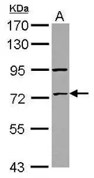 Anti-ZNF530 antibody used in Western Blot (WB). GTX123125