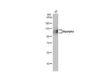 Anti-Atpalpha antibody [N2C1], Internal used in Western Blot (WB). GTX123137