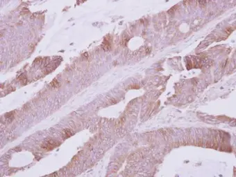 Anti-Atpalpha antibody [N2C1], Internal used in IHC (Paraffin sections) (IHC-P). GTX123137