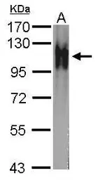 Anti-Atpalpha antibody [N2C1], Internal used in Western Blot (WB). GTX123137