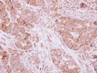 Anti-Atpalpha antibody used in IHC (Paraffin sections) (IHC-P). GTX123138