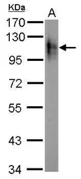 Anti-Atpalpha antibody used in Western Blot (WB). GTX123138