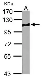 Anti-Atpalpha antibody used in Western Blot (WB). GTX123138
