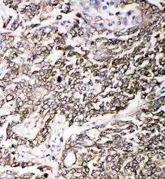 Anti-PMP70 antibody used in IHC (Paraffin sections) (IHC-P). GTX12314